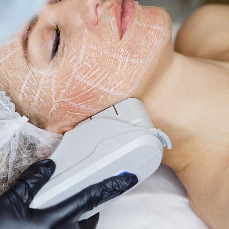 Skin Tightening & Lifting treatment at Milan Medical
